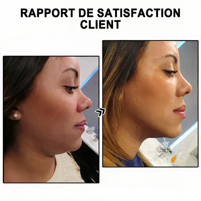 🔥𝐂𝐙𝐓𝐈𝐂𝐋𝐄® Lymphvity MagneTherapy Boucles d'oreilles en Germanium💎 (Portées une fois par jour, changements visibles en 7 jours) Soutien contre le surpoids, le diabète, l'apnée du sommeil et les douleurs articulaires 🍃