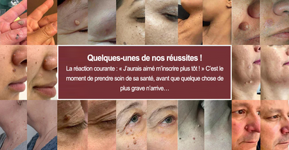 ✨Curalona® Patch micro-aiguilles et hydrocolloïde 2 en 1🍀 | Élimine les grains de beauté en relief, l'acné, les verrues planes et les acrochordons | Atténue les rides, les cicatrices et les imperfections | Patchs invisibles pour le visage et le corps