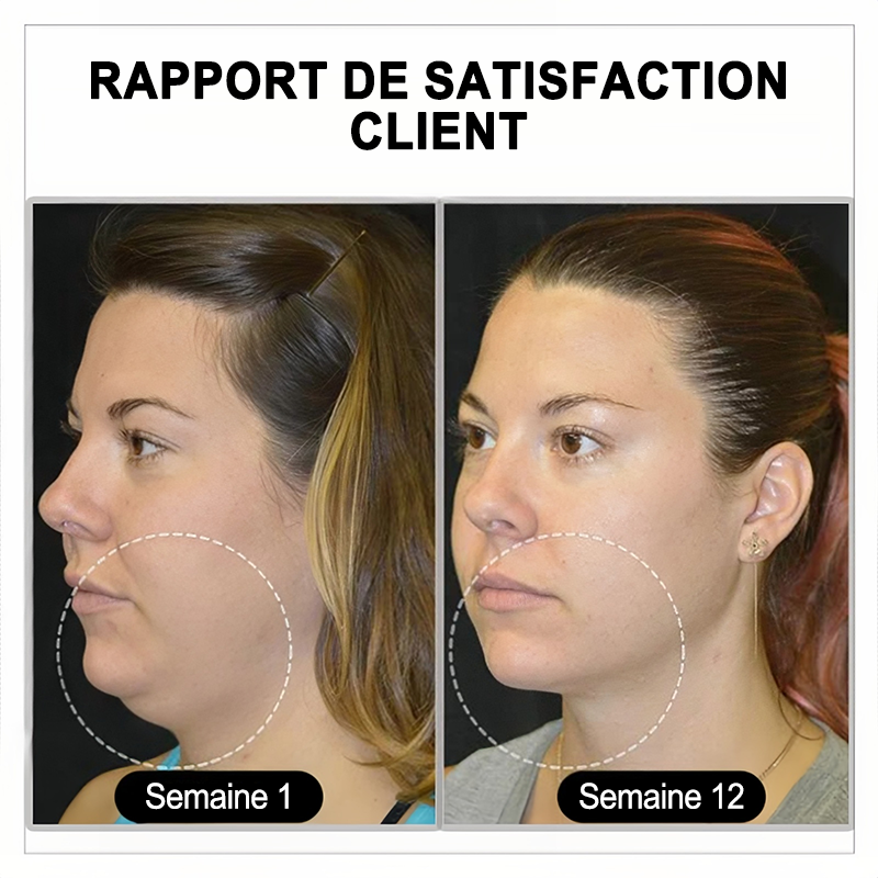 🔥𝐂𝐙𝐓𝐈𝐂𝐋𝐄® Lymphvity MagneTherapy Boucles d'oreilles en Germanium💎 (Portées une fois par jour, changements visibles en 7 jours) Soutien contre le surpoids, le diabète, l'apnée du sommeil et les douleurs articulaires 🍃