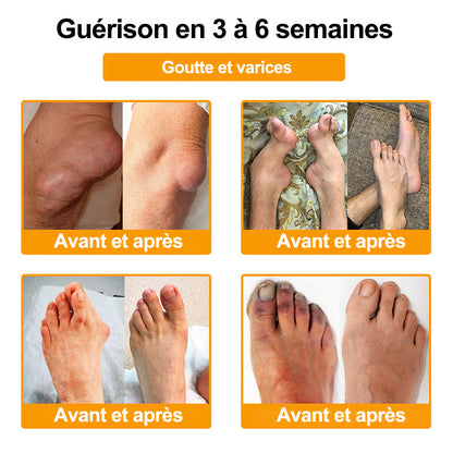 Purelora® Venin d'abeille Crème cicatrisante osseuse Pain-Relief 🐝🐝(Spécialement conçu pour les personnes âgées & Recommandé par Chirurgien)