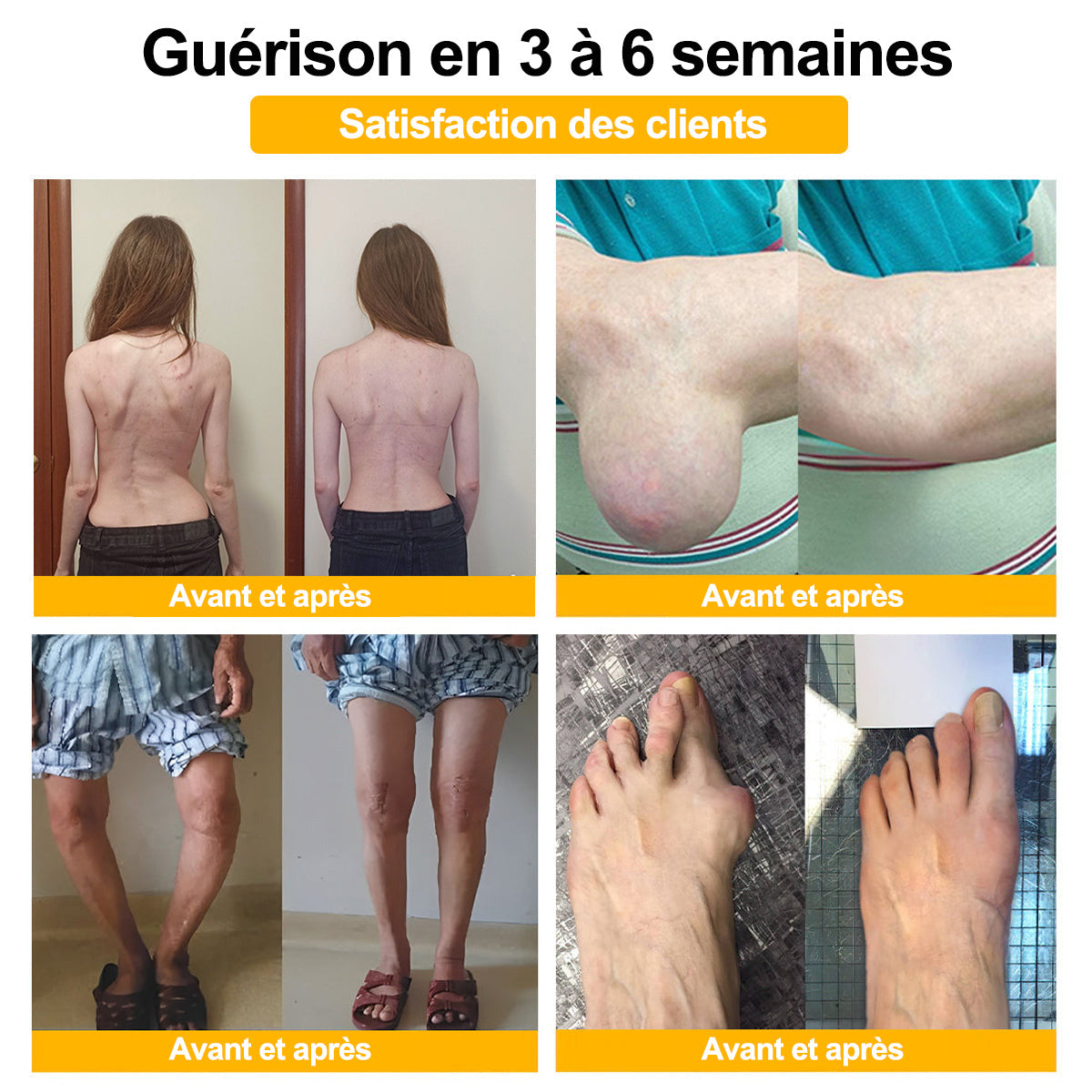 Purelora® Venin d'abeille Crème cicatrisante osseuse Pain-Relief 🐝🐝(Spécialement conçu pour les personnes âgées & Recommandé par Chirurgien)