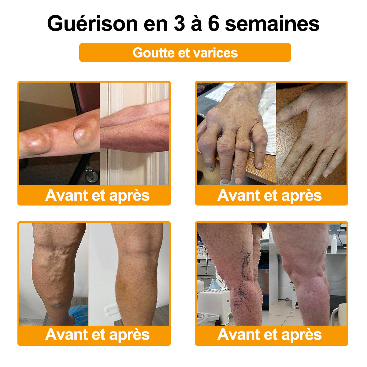 Purelora® Venin d'abeille Crème cicatrisante osseuse Pain-Relief 🐝🐝(Spécialement conçu pour les personnes âgées & Recommandé par Chirurgien)