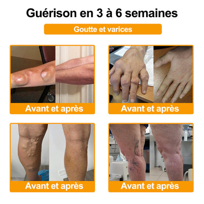 Purelora® Venin d'abeille Crème cicatrisante osseuse Pain-Relief 🐝🐝(Spécialement conçu pour les personnes âgées & Recommandé par Chirurgien)