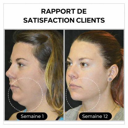 (💎 DERNIER JOUR – SOLDES 80%)💎 CZTICLE® Histone Magnetology Lymphvity Boucles d’Oreilles en Germanium