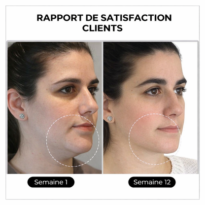 (💎 DERNIER JOUR – SOLDES 80%)💎 CZTICLE® Histone Magnetology Lymphvity Boucles d’Oreilles en Germanium
